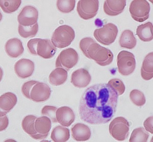 SEPTEMBER - 2020 - CASE #524 parasitic image