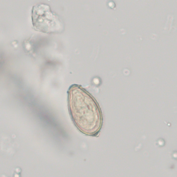 NOVEMBER - 2020 - CASE #527 parasitic image