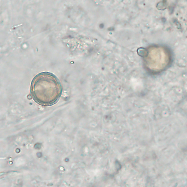 NOVEMBER - 2020 - CASE #528 parasitic image