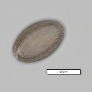 FEBRUARY - 2020 - CASE #509 parasitic image