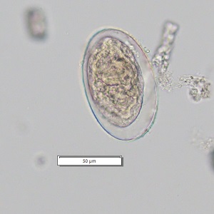 FEBRUARY - 2020 - CASE #510 parasitic image