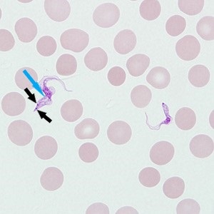 Case_514_B_Answer Case_514_answer