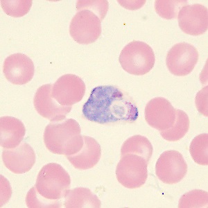 MAY - 2020 - CASE #515 parasitic image