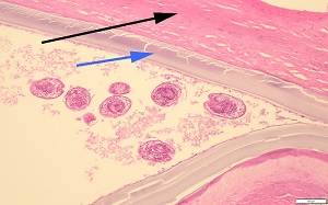 Case_513_A_Answer Case_513_answer