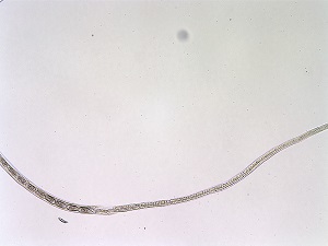 Case_518_C Case_518_C