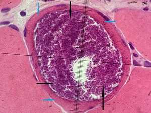 Case_519_A_Answer Case_519_answer