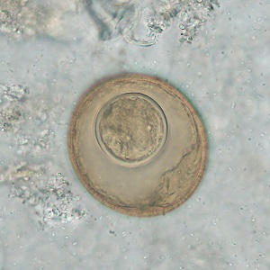 AUGUST - 2020 - CASE #521 parasitic image