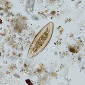 AUGUST - 2020 - CASE #522 parasitic image