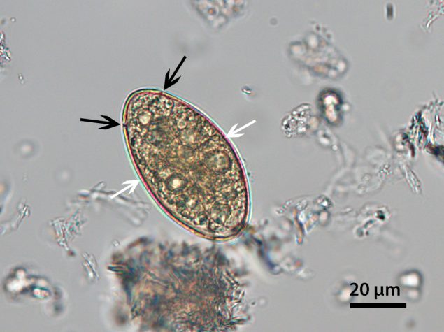 Spirometra_answer Spirometra_answer