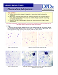 Laboratory Diagnosis of Plasmodium falciparum