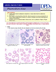 Laboratoy Diagnosis of Plasmodium vivax