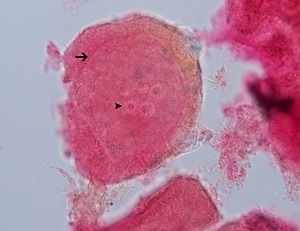 C2 Figure C: Carmine-stained egg capsule of <em>I. madagascariensis</em> freed from proglottid. Note the visible cluster of eggs (dart; 5 in this specimen) and the division of two “zones” (arrow) making up the inner and outer portions of the egg capsule.