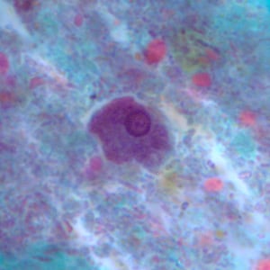 Epolecki_troph_tric2.jpg Figure C