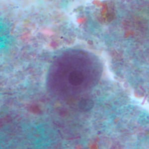 Epolecki_troph_tric3.jpg Figure D