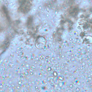 Iodamoeba_wtmt_BAM4.jpg Figure A