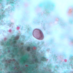 I_buetschlii_cyst_trich_BAM1.jpg Figure A