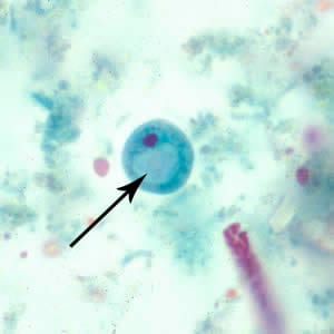 Ibuetschlii_cyst_tric.jpg Figure C