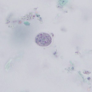 E_nana_cyst_trich_BAM1.jpg Figure B