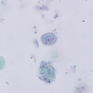 E_nana_cyst_trich_BAM3.jpg Figure D