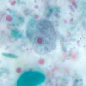 Enana_troph_tric.jpg Figure A: Trophozoite of <em>E. nana</em> stained with trichrome.