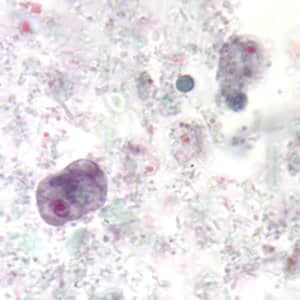 Enana_troph_tric2.jpg Figure B: Trophozoites of <em>E. nana</em> stained with trichrome.