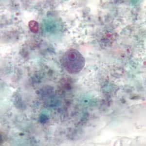 Enana_troph_tric3.jpg Figure C: Trophozoite of <em>E. nana</em> stained with trichrome.