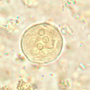 Ecoli_cyst_wtmt.jpg Figure A: Cyst of <em>E. coli</em> in a unstained concentrated wet mount. Six nuclei are visible in this focal plane.