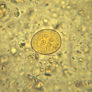 Ecoli_cyst_wtmt2.jpg Figure B: Cyst of <em>E. coli</em> in a concentrated wet mount stained with iodine. Five nuclei are visible in this focal plane.