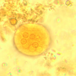 Ecoli_cyst_wtmt3.jpg Figure D: Cyst of <em>E. coli</em> in a concentrated wet mount stained with iodine. Five nuclei are visible in this focal plane.
