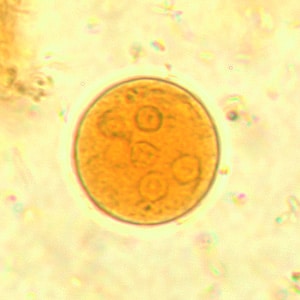 Ecoli_cyst_wtmt5.jpg Figure C: Cyst of <em>E. coli</em> in a concentrated wet mount stained with iodine. Seven nuclei are visible in this focal plane.