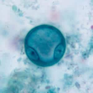Ecoli_cyst_tric.jpg Figure A
