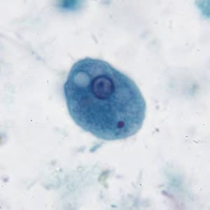 Ecoli_troph_tric.jpg Figure A