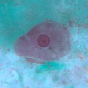 Ecoli_troph_tric2.jpg Figure B