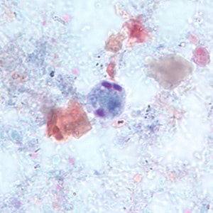 E_hartmanni_cyst_trich_BAM1.jpg Figure A