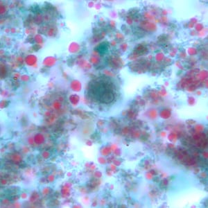 E_hartmanni_cyst_trich_BAM7.jpg Figure B