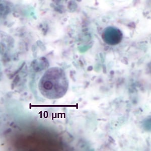 Ehartmanni_troph_tric4.jpg Figure C