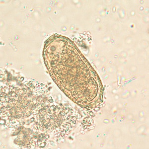 C_philippinensis_egg2.jpg Figure B