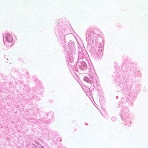 C_philippinensis_tissue5.jpg Figure B: Longitudinal section of an adult of <em>C. philippinensis</em> from an intestinal biopsy specimen stained with hematoxylin and eosin (H&E).