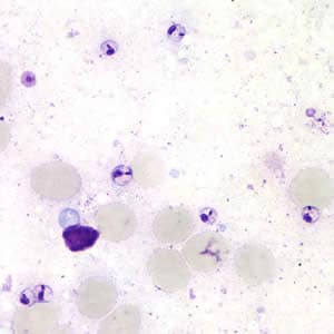 Figure B: <em>Leishmania</em> sp. amastigotes; touch-prep stained with Giemsa.