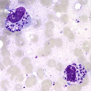 Figure A: <em>Leishmania</em> sp. amastigotes; touch-prep stained with Giemsa.