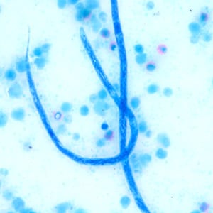 Figure H: Higher magnification of the microfilariae in Figure G, taken at 500x oil magnification.