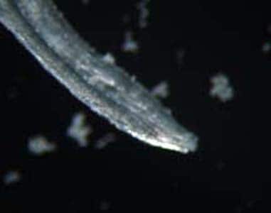 Figure B: Adult of <em>L. loa</em> removed from the eye of a patient. Image courtesy of the Georgia State Public Health Laboratory.