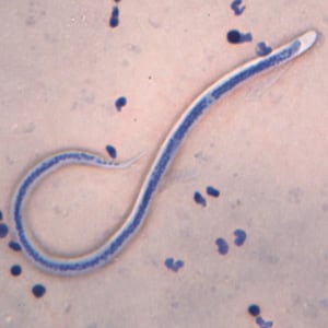 W_bancrofti_ORb.jpg Figure B: Microfilaria of <em>W. bancrofti</em> in a thick blood smear stained with Giemsa. Image courtesy of the Oregon State Public Health Laboratory.