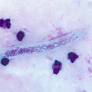 W_bancrofti_anterior_BAM2.jpg Figure D: Close-up of the anterior end of the worm in Figure C.