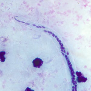 W_bancrofti_posterior_BAM2.jpg Figure E: Close-up of the posterior end of the worm in Figure C.