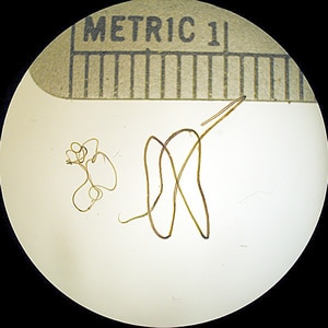 Wbancrofti_adults2.jpg Figure A: Adults of <em>W. bancrofti</em>. The male worm is on the left; the female is on the right.