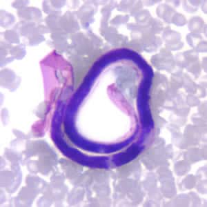 Brugia_malayi2.jpg Figure B: Microfilaria of <em>B. malayi</em> in a thin blood smear, stained with Giemsa.