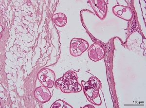 Brugia_C Figure C