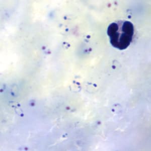 Pf_rings_thickB.jpg Figure B: Rings of <em>P. falciparum</em> in a thick blood smear.