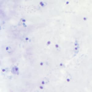 Pf_rings_thickC.jpg Figure C: Rings of <em>P. falciparum</em> in a thick blood smear.